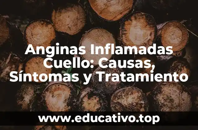 Anginas Inflamadas Cuello: Causas, Síntomas y Tratamiento