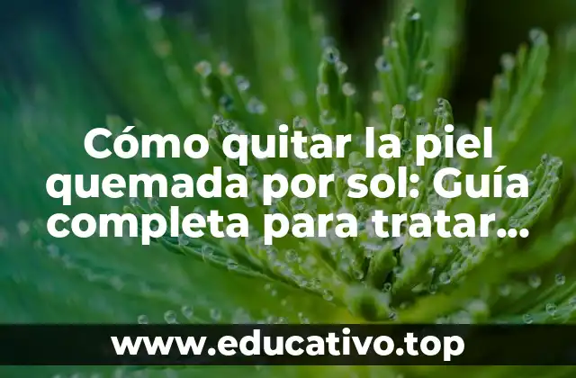 ¿Qué son las quemaduras solares y cómo se producen?
