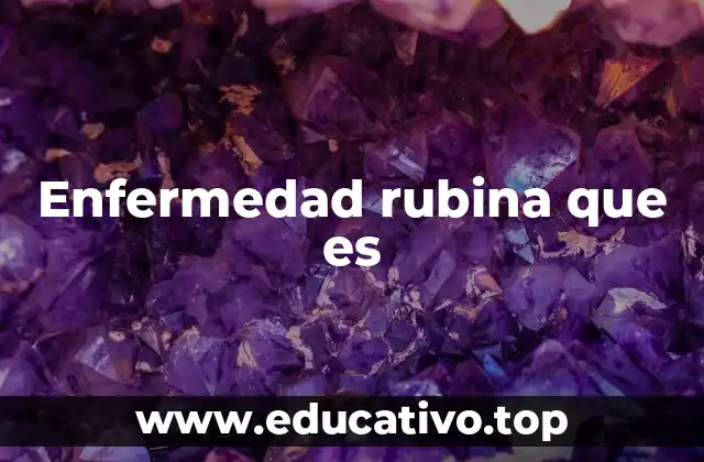 Enfermedad rubina que es