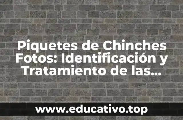 Piquetes de Chinches Fotos: Identificación y Tratamiento de las Picaduras