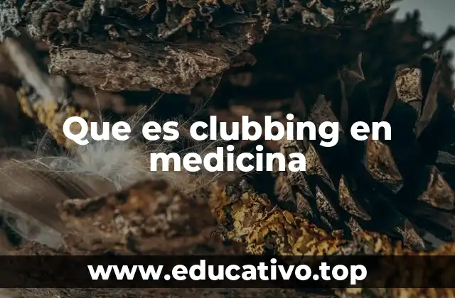 Que es clubbing en medicina