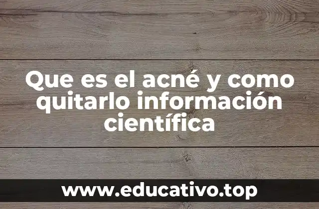 Que es el acné y como quitarlo información científica