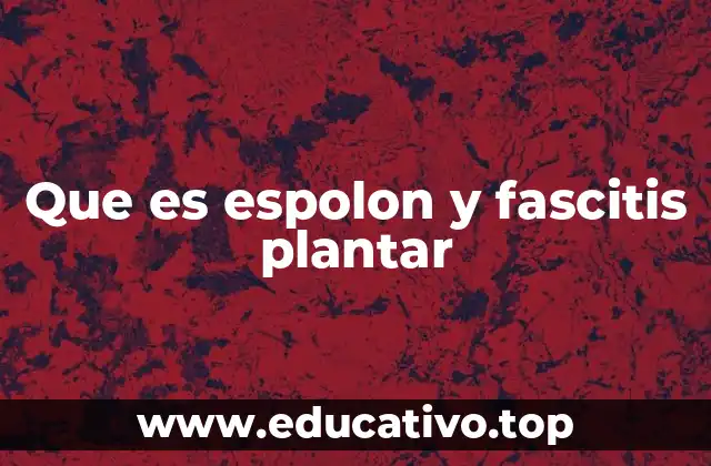 Que es espolon y fascitis plantar