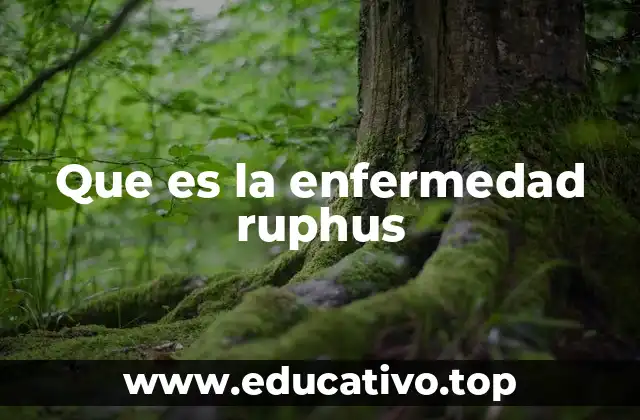 Que es la enfermedad ruphus