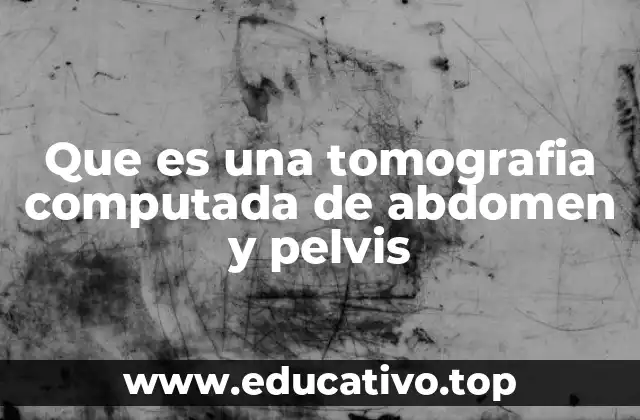 Cómo funciona la tecnología detrás de la tomografía