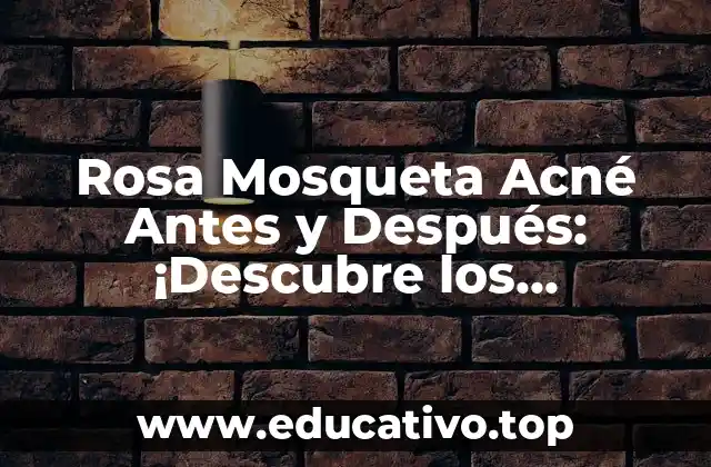 Rosa Mosqueta Acné Antes y Después: ¡Descubre los Resultados Sorprendentes!