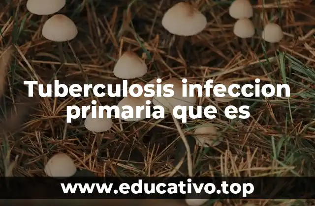 Tuberculosis infeccion primaria que es